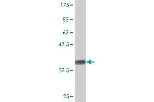 Western Blot detection against Immunogen (37. (Sorting Nexin 1 Antikörper  (AA 166-275))