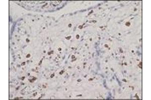 Immunohistochemistry (IHC) image for anti-CD163 (CD163) (N-Term) antibody (ABIN870405) (CD163 Antikörper  (N-Term))