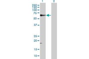 Lane 1: TGFB1 transfected lysate ( 44. (TGFB1 293T Cell Transient Overexpression Lysate(Denatured))