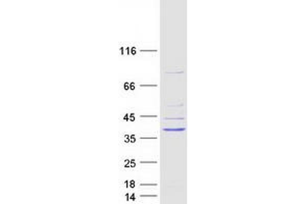 GTPase, IMAP Family Member 1 (GIMAP1) protein (Myc-DYKDDDDK Tag)