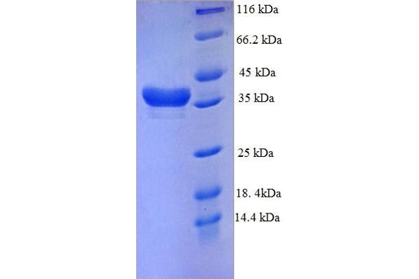 DTWD1 Protein (AA 1-109, partial) (GST tag)