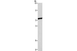 Western Blotting (WB) image for anti-ATP-Binding Cassette, Sub-Family B (MDR/TAP), Member 8 (ABCB8) antibody (ABIN2427719) (ABCB8 Antikörper)