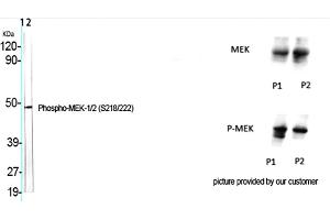 Western Blot analysis of various cells using Phospho-MEK-1/2 (S218/222) Polyclonal Antibody. (MEK1/2 Antikörper  (pSer218, pSer222))