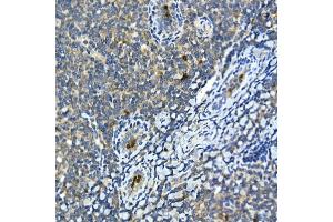 Immunohistochemistry of paraffin-embedded human tonsil using MMP9 Rabbit pAb (ABIN6134758, ABIN6143921, ABIN6143924 and ABIN6215080) at dilution of 1:100 (40x lens). (MMP 9 Antikörper  (AA 400-500))