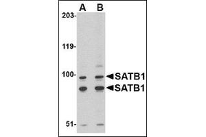 Western blot analysis of SATB1 in A20 cell lysate with this product at (A) 2 and (B) 4 μg/ml. (SATB1 Antikörper  (C-Term))