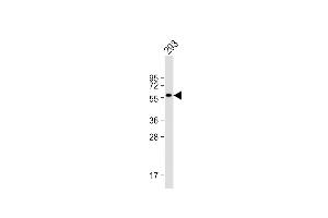 Anti-CNOT4 Antibody at 1:8000 dilution + 293 whole cell lysate Lysates/proteins at 20 μg per lane. (CNOT4 Antikörper)