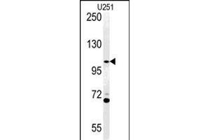Western blot analysis of AC Antibody (N-term) (ABIN651370 and ABIN2840207) in  cell line lysates (35 μg/lane). (Acap3 Antikörper  (N-Term))