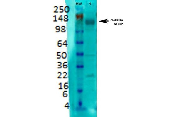 KCC2 Antikörper  (AA 932-1043) (HRP)
