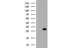 Image no. 1 for anti-B-Cell CLL/lymphoma 10 (BCL10) antibody (ABIN1496851) (BCL10 Antikörper)