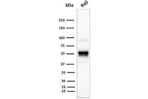 Western Blot Analysis of human Rajj cell lysate using CD79a Monoclonal Antibody (SPM549). (CD79a Antikörper  (AA 202-216))