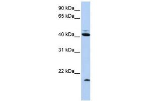 Ubiquitin D antibody used at 1 ug/ml to detect target protein. (UBD Antikörper  (N-Term))