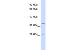 WB Suggested Anti-INMT Antibody Titration:  0. (INMT Antikörper  (N-Term))