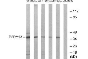 Western Blotting (WB) image for anti-Purinergic Receptor P2Y, G-Protein Coupled, 13 (P2RY13) (Internal Region) antibody (ABIN1853312) (Purinergic Receptor P2Y, G-Protein Coupled, 13 (P2RY13) (Internal Region) Antikörper)