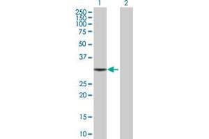 Western Blot analysis of TBCB expression in transfected 293T cell line by TBCB MaxPab polyclonal antibody. (TBCB Antikörper  (AA 1-244))