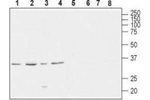 Western blot analysis of rat brain (lanes 1 and 5), mouse brain (lanes 2 and 6), human SH-SY5Y brain neuroblastoma (lanes 3 and 7) and  rat PC12 pheochromocytoma adrenal gland (lanes 4 and 8) lysates: - 1-4. (CACNG4 Antikörper  (C-Term, Intracellular))