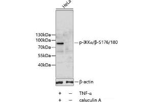 Western blot analysis of extracts of HeLa cells using Phospho-IKKα/β(S176/180) Polyclonal Antibody. (IKK-alpha /IKK-beta Antikörper  (pSer176, pSer180))