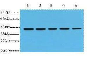 Western Blotting (WB) image for anti-Actin, beta (ACTB) antibody (ABIN3181101) (beta Actin Antikörper)