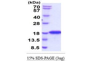 SDS-PAGE (SDS) image for DNA segment, Chr 17, Wayne State University 104, expressed (D17Wsu104e) (AA 25-166) protein (His tag) (ABIN6388124) (MYDGF Protein (AA 25-166) (His tag))