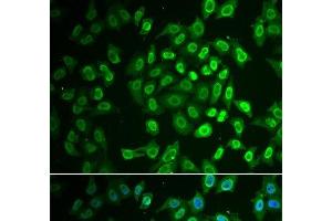 Immunofluorescence analysis of A549 cells using FAH Polyclonal Antibody (FAH Antikörper)
