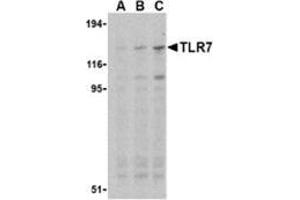 Western blot analysis of TLR7 in Daudi cell lysates with this product at (A) 0. (TLR7 Antikörper  (Middle Region))