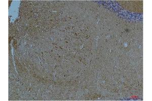 Immunohistochemistry (IHC) analysis of paraffin-embedded Mouse Brain Tissue using Kv11. (KCNH7 Antikörper)