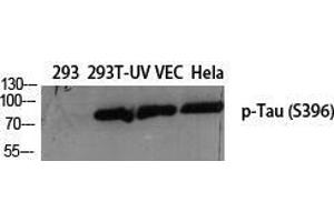 Western Blot (WB) analysis of specific cells using Phospho-Tau (S396) Polyclonal Antibody. (tau Antikörper  (pSer396))
