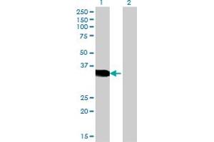 Western Blot analysis of CRX expression in transfected 293T cell line by CRX monoclonal antibody (M06), clone 4A12. (CRX Antikörper  (AA 1-299))