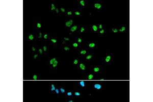 Immunofluorescence analysis of A549 cells using PAX2 Polyclonal Antibody (PAX2A Antikörper)