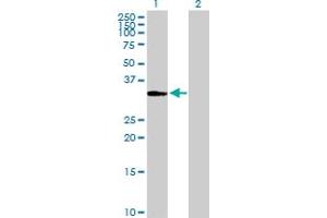 Western Blot analysis of ITPK1 expression in transfected 293T cell line by ITPK1 MaxPab polyclonal antibody. (ITPK1 Antikörper  (AA 1-314))