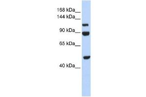 NARG1L antibody used at 1 ug/ml to detect target protein. (NARG1L Antikörper  (Middle Region))