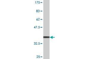 Western Blot detection against Immunogen (36. (HKDC1 Antikörper  (AA 102-200))