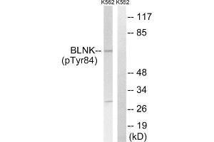 Western Blotting (WB) image for anti-B-Cell Linker (BLNK) (pTyr84) antibody (ABIN1847670) (B-Cell Linker Antikörper  (pTyr84))