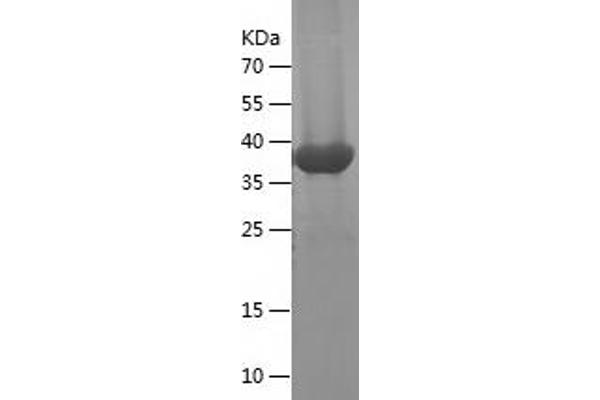 IL-18 Protein (AA 37-193) (His-IF2DI Tag)