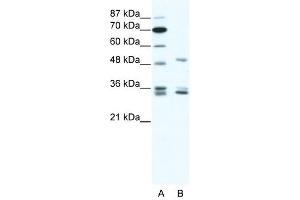 Western Blot showing ZNF488 antibody used at a concentration of 1-2 ug/ml to detect its target protein. (ZNF488 Antikörper  (C-Term))