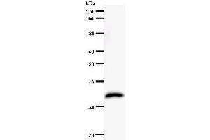 Western Blotting (WB) image for anti-General Transcription Factor IIH, Polypeptide 4, 52kDa (GTF2H4) antibody (ABIN931120) (GTF2H4 Antikörper)