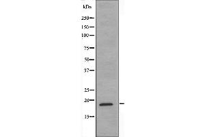 Western blot analysis of extracts from A549 cells, using Myelodysplasia Syndrome 1 antibody. (MDS1 Antikörper)