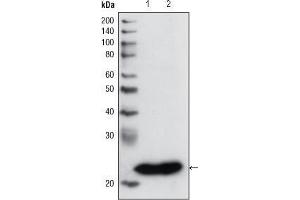 Western Blot showing using GSTP1 antibody used against PC3 cell lysate (1) and human cerebellum tissue lysate (2). (GSTP1 Antikörper)