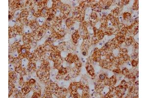 IHC image of ABIN7127551 diluted at 1:100 and staining in paraffin-embedded human liver tissue performed on a Leica BondTM system. (Rekombinanter HSPD1 Antikörper)