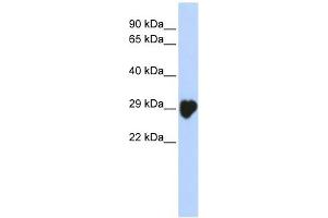 Carbonic Anhydrase I antibody used at 1 ug/ml to detect target protein. (CA1 Antikörper  (N-Term))