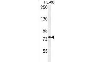 Western Blotting (WB) image for anti-Carnitine Palmitoyltransferase 1C (CPT1C) antibody (ABIN2996207) (CPT1C Antikörper)