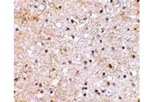 Immunohistochemistry (IHC) image for anti-Glutamate Receptor, Ionotropic, Kainate 1 (GRIK1) (C-Term) antibody (ABIN1030421) (GRIK1 Antikörper  (C-Term))