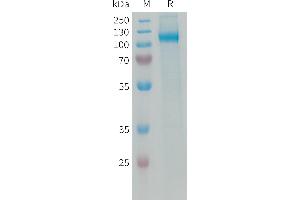 Human Protein, His Tag on SDS-PAGE under reducing condition. (AOC3 Protein (AA 28-763) (His tag))