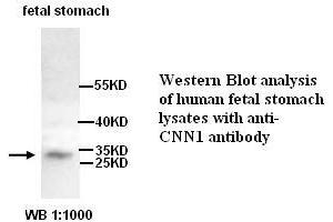 Image no. 1 for anti-Calponin antibody (ABIN790877) (Calponin Antikörper)