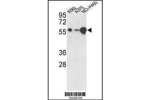 Western blot analysis of hUSP3-Y505 in K562, A375, NCI-H460 cell line lysates (35ug/lane) (USP3 Antikörper  (C-Term))