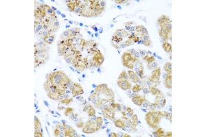 Immunohistochemistry of paraffin-embedded human stomach using PIP4K2B antibody. (PIP4K2B Antikörper)