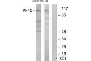 Western blot analysis of extracts from COLO205/Jurkat cells, using AF10 Antibody. (MLLT10 Antikörper  (AA 211-260))