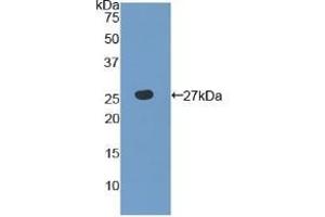 Detection of Recombinant TLR6, Human using Polyclonal Antibody to Toll Like Receptor 6 (TLR6) (TLR6 Antikörper  (AA 608-796))