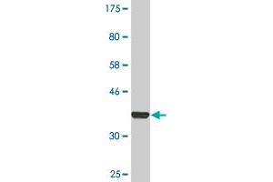 Western Blot detection against Immunogen (36. (Transferrin Receptor Antikörper  (AA 68-168))