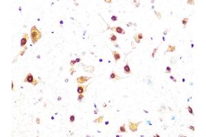 Immunohistochemistry of paraffin-embedded mouse spinal cord using Casein Kinase 2 beta (CSNK2B) (CSNK2B) Rabbit mAb (ABIN1680593, ABIN3019007, ABIN3019008 and ABIN7101698) at dilution of 1:100 (40x lens). (CSNK2B Antikörper)