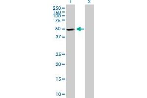 Western Blot analysis of ZNF383 expression in transfected 293T cell line by ZNF383 MaxPab polyclonal antibody. (ZNF383 Antikörper  (AA 1-475))